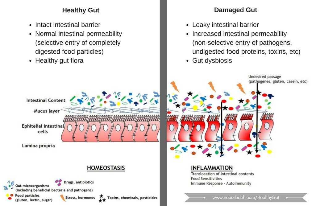 healthy vs damaged gut